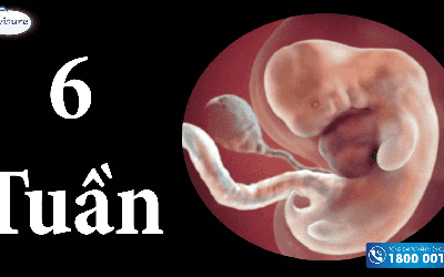 Thai 6 tuần không nghén có sao không? Nguyên nhân vì sao?