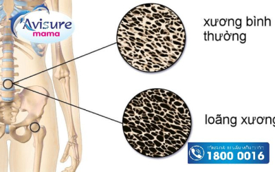 Vitamin D cho bà bầu có thực sự cần thiết?