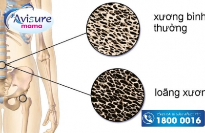 Vitamin D cho bà bầu có thực sự cần thiết?