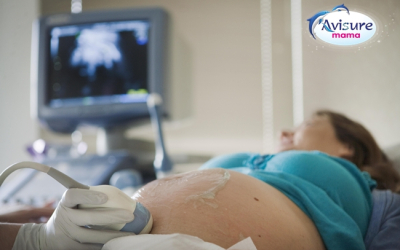 Những thắc mắc thường gặp khi mẹ siêu âm thai