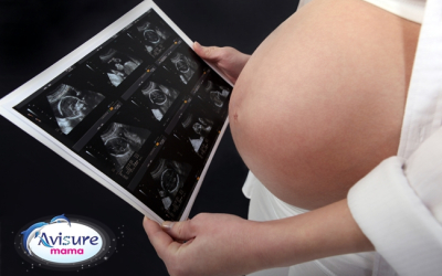 Siêu âm tuần 32 – Mốc thời điểm quan trọng