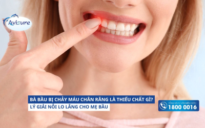 Bà bầu bị chảy máu chân răng là thiếu chất gì?