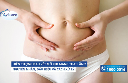 Hiện tượng đau vết mổ khi mang thai lần 2: Nguyên nhân, dấu hiệu và cách xử lý 