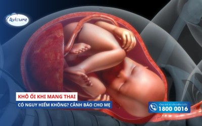 Khô ối khi mang thai có nguy hiểm không? Dấu hiệu cảnh báo mẹ có biết?