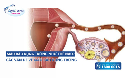 Máu báo rụng trứng như thế nào? Những vấn đề về máu báo rụng trứng?