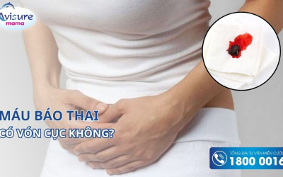 Máu báo thai có vón cục không? Chuyên gia giải đáp