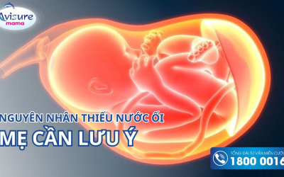 Nguyên nhân thiếu nước ối nghiêm trọng mẹ bầu cần lưu ý ngay