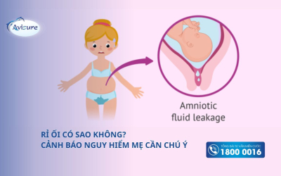 Rỉ ối có sao không? Cảnh báo các trường hợp nguy hiểm mẹ cần chú ý
