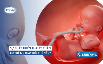 Sự phát triển của thai 20 tuần. Cơ thể mẹ thay đổi thế nào?