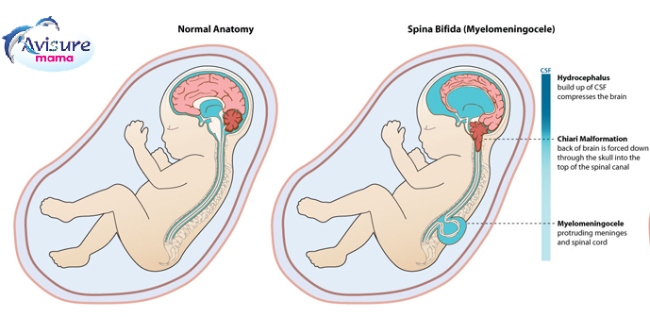 Folate mới ngăn ngừa dị tật bẩm sinh ở thai nhi.