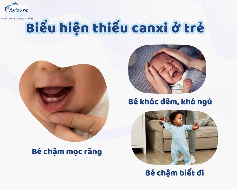 Biểu hiện thiếu canxi ở trẻ