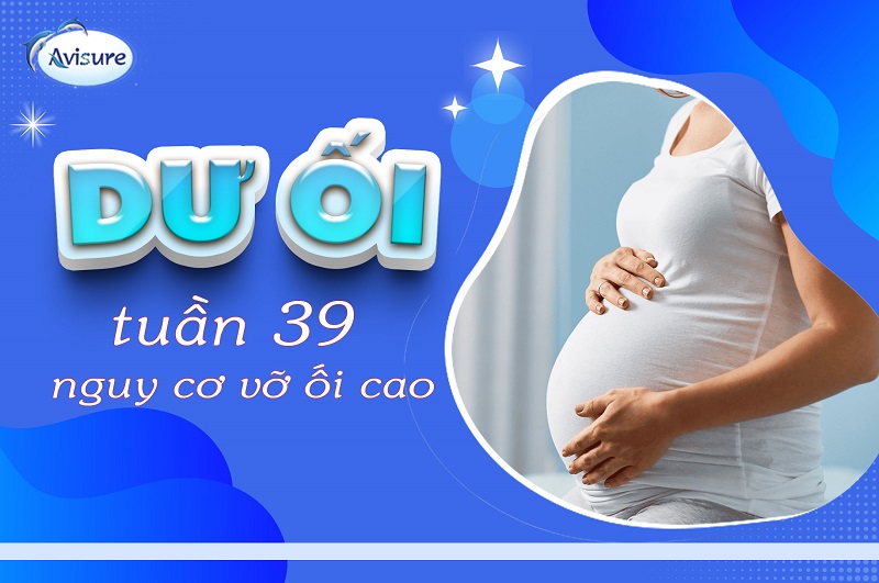 Dư ối tuần 39 có nguy cơ vỡ ối cực kỳ cao