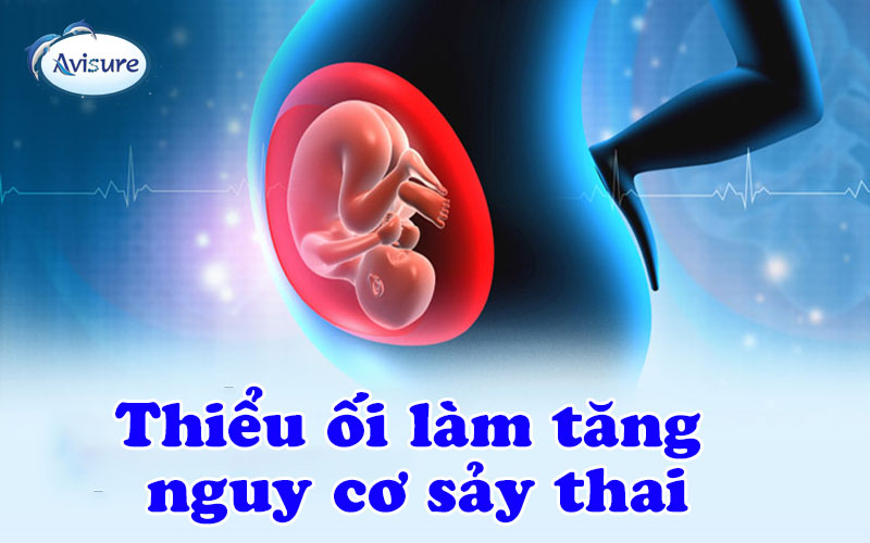 Thiểu ối làm tăng nguy cơ sảy thai