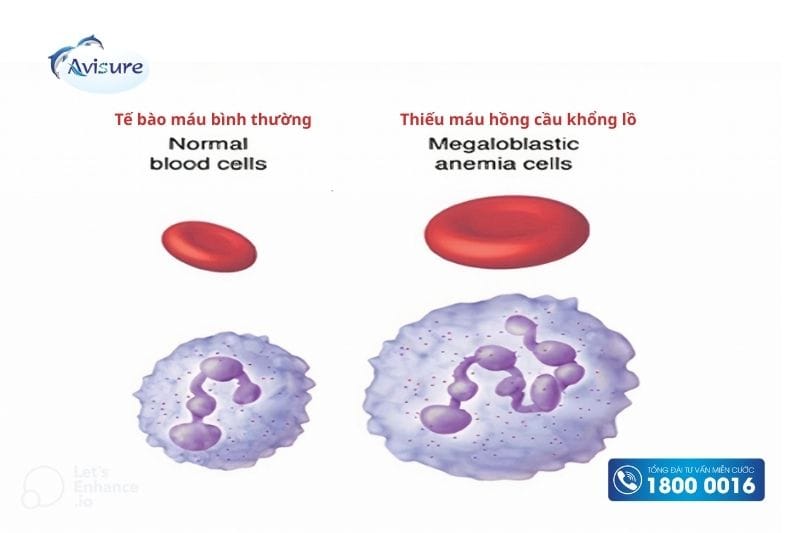 5-mthf có tác dụng phòng thiếu máu