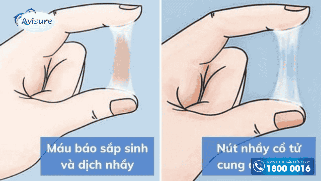 Nút nhầy tử cung là gì? 