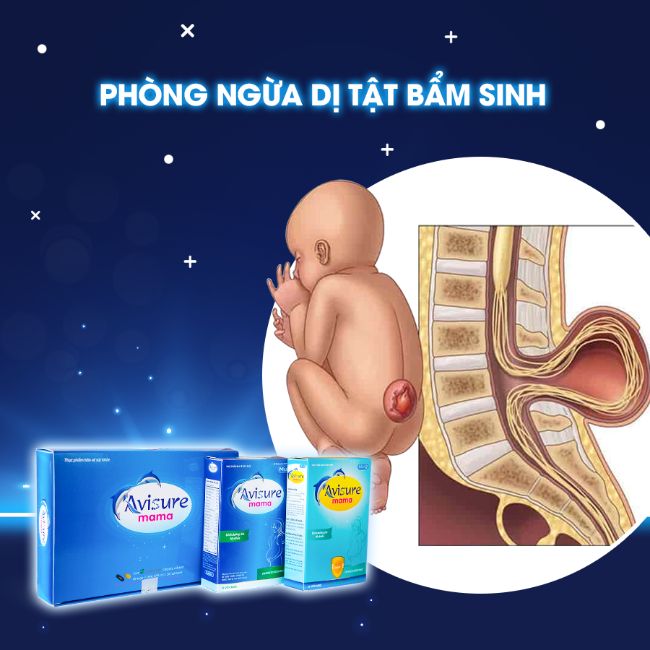 Thuốc bổ trước khi mang bầu