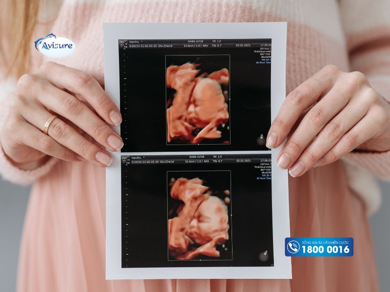 Cách đọc kết quả siêu âm cân nặng thai nhi như thế nào đúng?