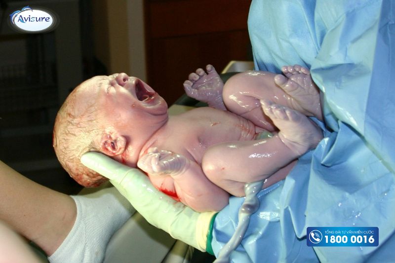 dấu hiệu bà bầu đau đẻ chuyển dạ