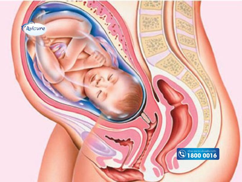 Dây rốn quấn cổ 2 vòng tuần 35 với những nguy cơ tiềm ẩn