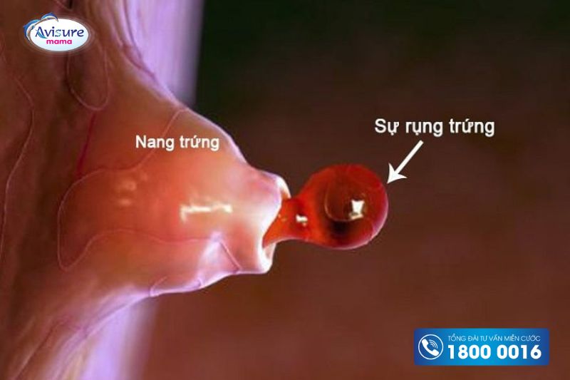 Máu báo rụng trứng như thế nào