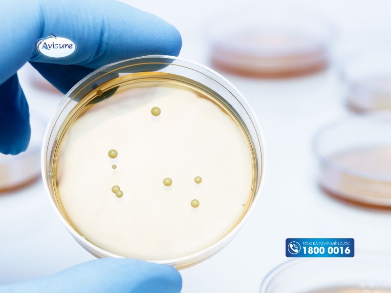 Một số lưu ý khi sử dụng men vi sinh Lactobacillus trong thực phẩm