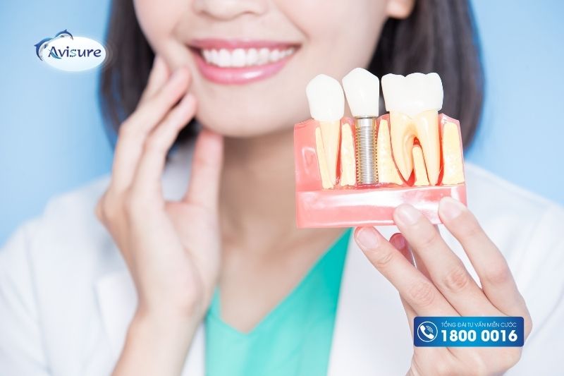 nano canxi hydroxyapatite trồng răng implant