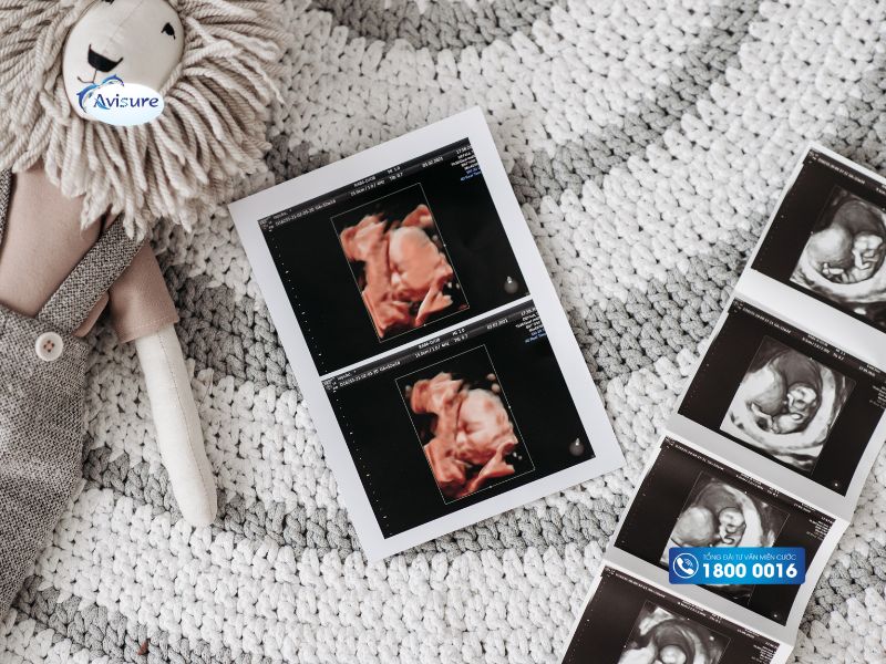 Những lưu ý khi quan trọng khi mang thai đôi 1 trai 1 gái tự nhiên