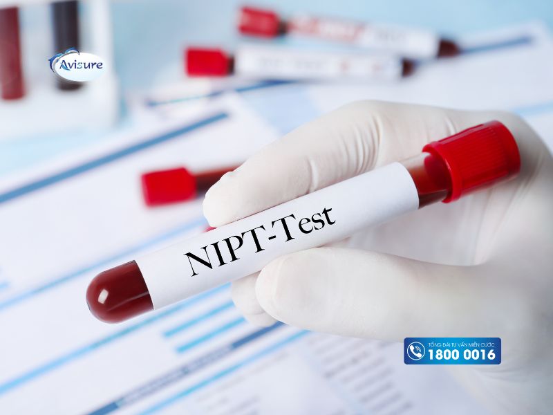 Xét nghiệm NIPT - Phương pháp xác định giới tính thai nhi
