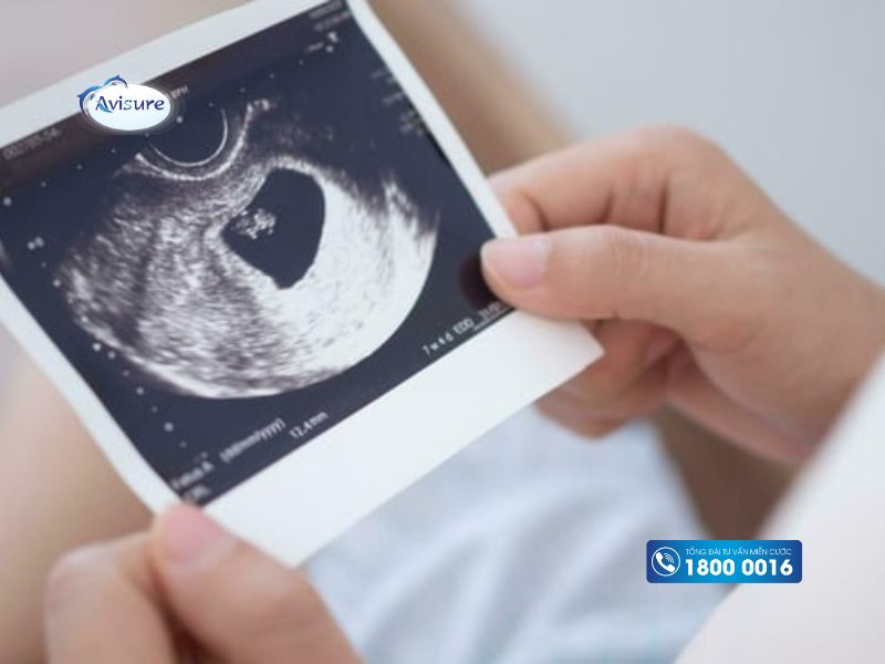 Thai 7 tuần có yolksac chưa có phôi có sao không? 