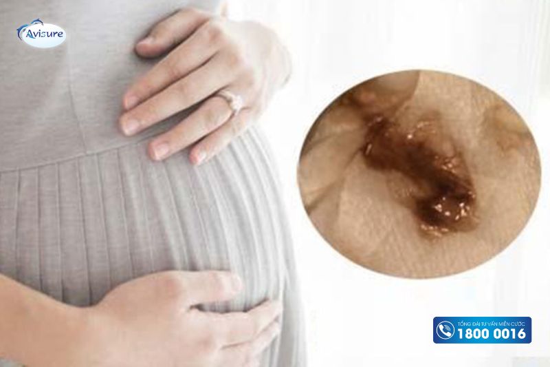 thai 8 tuần ra dịch nâu không đau bụng có sao không
